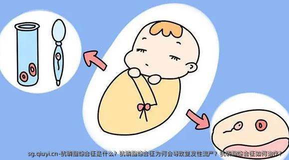 抗磷脂综合征是什么？抗磷脂综合征为何会导致复发性流产？抗磷脂综合征如何治疗？