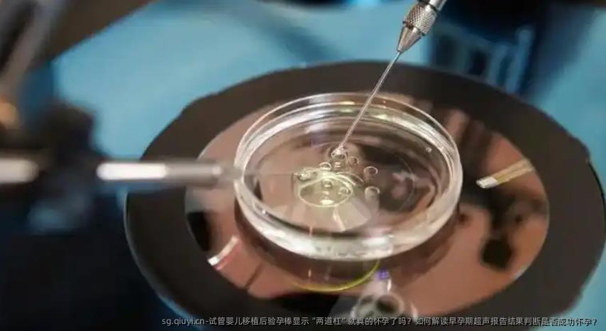 试管婴儿移植后验孕棒显示“两道杠”就真的怀孕了吗？如何解读早孕期超声报告结果判断是否成功怀孕？