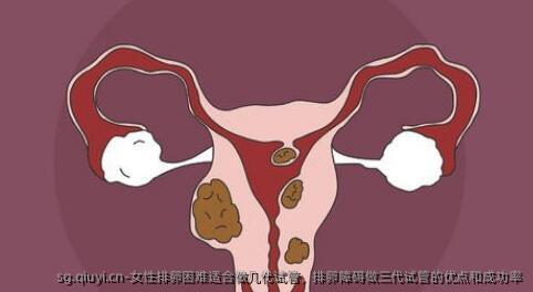 女性排卵困难适合做几特需障碍做三代试管的优点和成功率