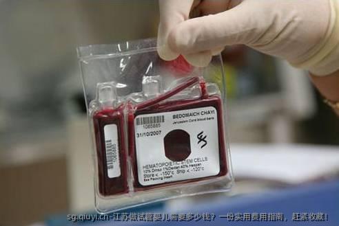 江苏做试管婴儿需要多少钱？一份实用费用指南，赶紧收藏！
