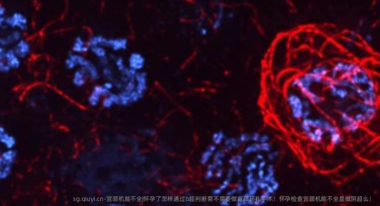 宫颈机能不全|怀孕了怎样通过b超判断需不需要做宫颈环扎手术！怀孕检查宫颈机能不全是做阴超么！