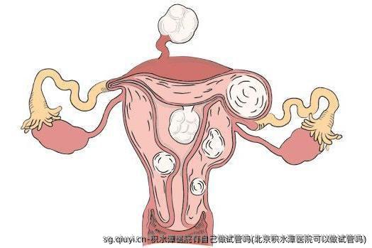 积水潭医院有自己做试管吗(北京积水潭医院可以做试管吗)