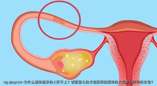 为什么越来越多的人怀不上？试管婴儿技术能否帮助因年龄大而难以怀孕的女性？
