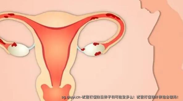 试管打促排后卵子有可能变多么！试管打促排针卵泡会破吗！