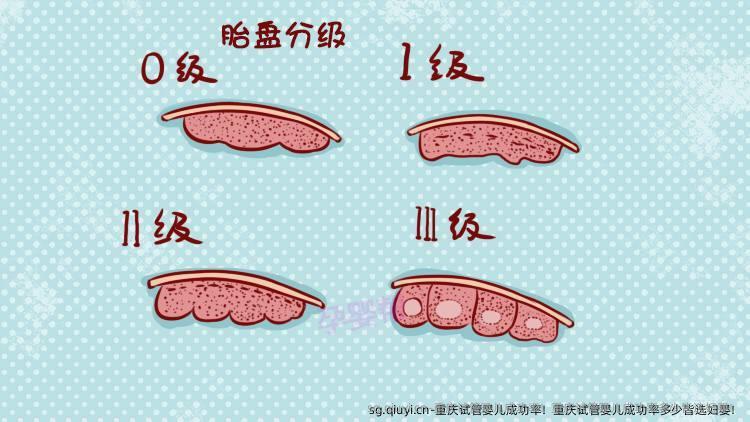 重庆试管婴儿成功率！重庆试管婴儿成功率多少皆选妇婴！
