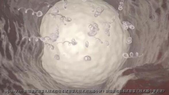新加坡试管婴儿技术和日本试管婴儿技术对比哪个好？新加坡和日本试管婴儿技术哪个更先进？