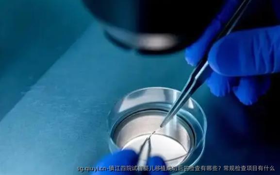 镇江四院试管婴儿移植成功后的检查有哪些？常规检查项目有什么