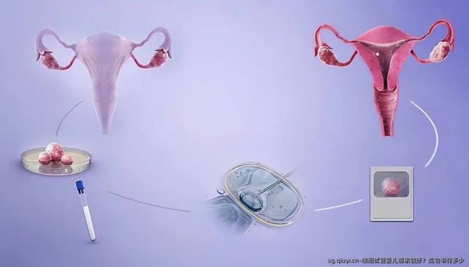 绵阳试管婴儿哪家较好？成功率有多少