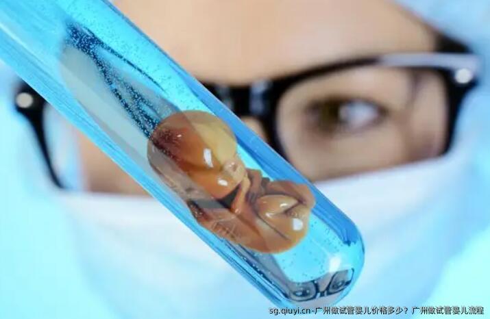 广州做试管婴儿价格多少？广州做试管婴儿流程