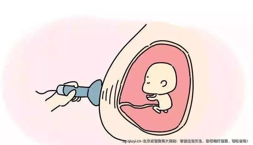 北京试管费用大揭秘：掌握这些方法，助您精打细算，轻松省钱！