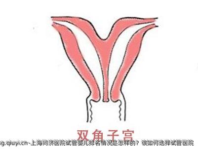 上海同济医院试管婴儿排名情况是怎样的？该如何选择试管医院