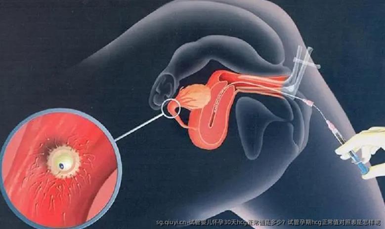 试管婴儿怀孕30天hcg正常值是多少？试管孕期hcg正常值对照表是怎样呢