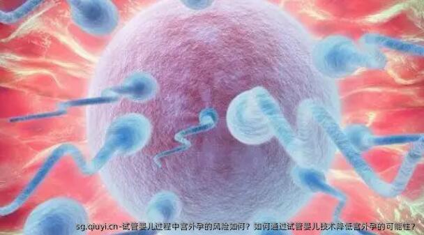 试管婴儿过程中宫外孕的风险如何？如何通过试管婴儿技术降低宫外孕的可能性？
