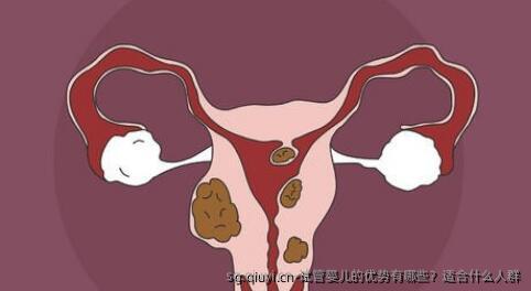 试管婴儿的优势有哪些？适合什么人群
