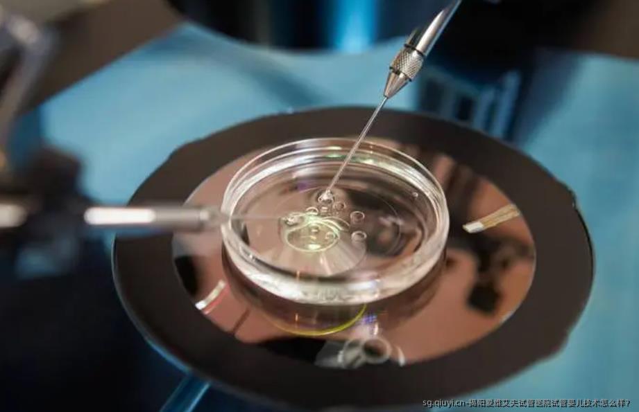 揭阳爱维艾夫试管医院试管婴儿技术怎么样？