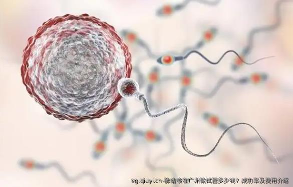 肺结核在广州做试管多少钱？成功率及费用介绍