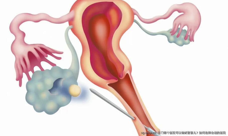 江门哪个医院可以做试管婴儿？如何选择合适的医院