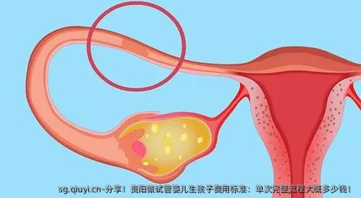 分享！贵阳做试管婴儿生孩子费用标准：单次完整流程大概多少钱！