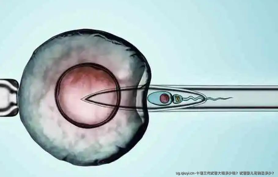 十堰三代试管大概多少钱？试管婴儿花销是多少？