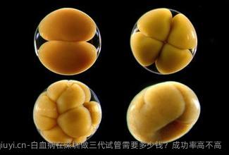 白血病在深圳做三代试管需要多少钱？成功率高不高