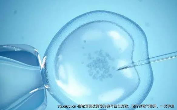揭秘泰国试管婴儿超详细全流程：治疗过程与费用，一文讲清