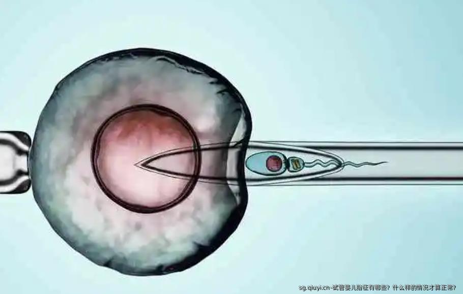 试管婴儿指征有哪些？什么样的情况才算正常？