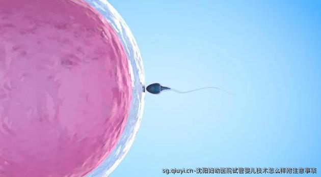 沈阳妇幼医院试管婴儿技术怎么样附注意事项