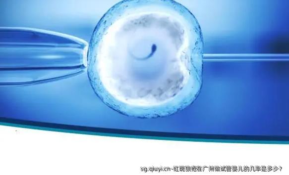 红斑狼疮在广州做试管婴儿的几率是多少？