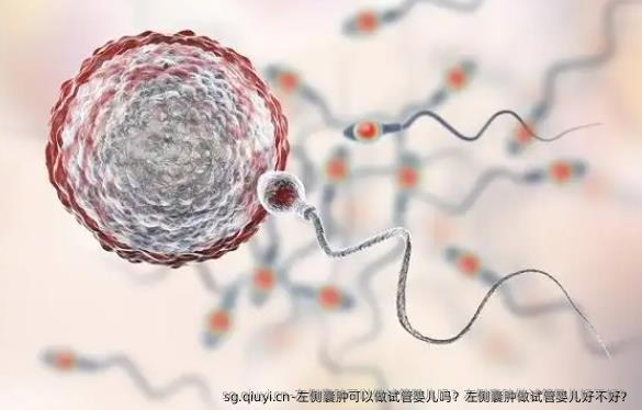 左侧囊肿可以做试管婴儿吗？左侧囊肿做试管婴儿好不好？