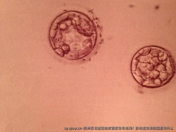 扬州苏北医院做试管成功率高吗？影响成功率的因素有什么