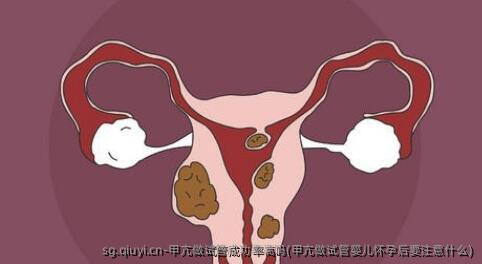 甲亢做试管成功率高吗(甲亢做试管婴儿怀孕后要注意什么)