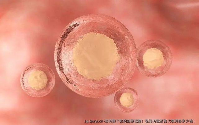 临沂那个医院能做试管！在临沂做试管大概需要多少钱！