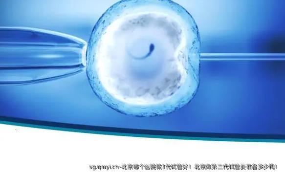 北京哪个医院做3代试管好！北京做第三代试管要准备多少钱！