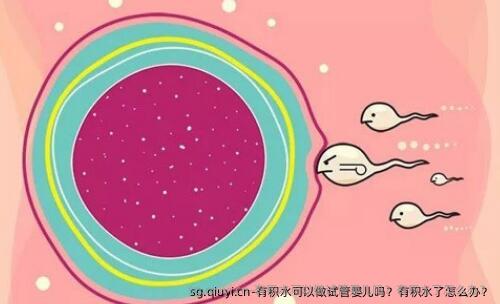 有积水可以做试管婴儿吗？有积水了怎么办？