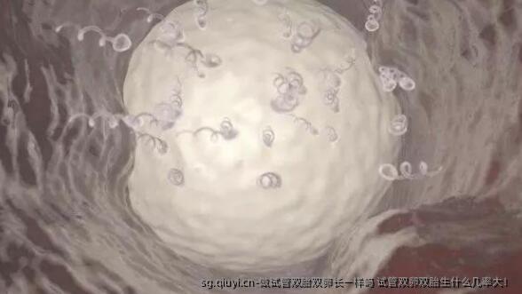 做试管双胎双卵长一样吗 试管双卵双胎生什么几率大！