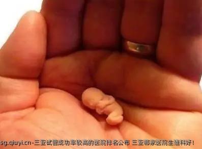 三亚试管成功率较高的医院排名公布 三亚哪家医院生殖科好！