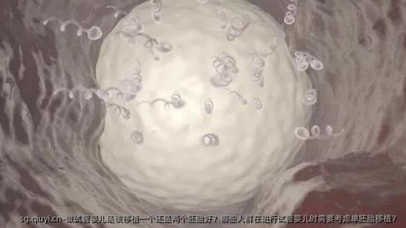 做试管婴儿是该移植一个还是两个胚胎好？哪些人群在进行试管婴儿时需要考虑单胚胎移植？