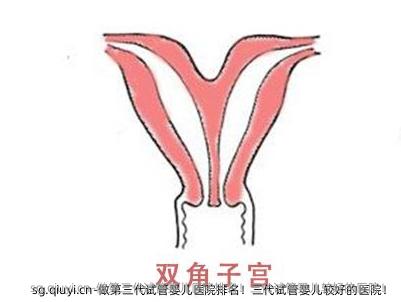 做第三代试管婴儿医院排名！三代试管婴儿较好的医院！