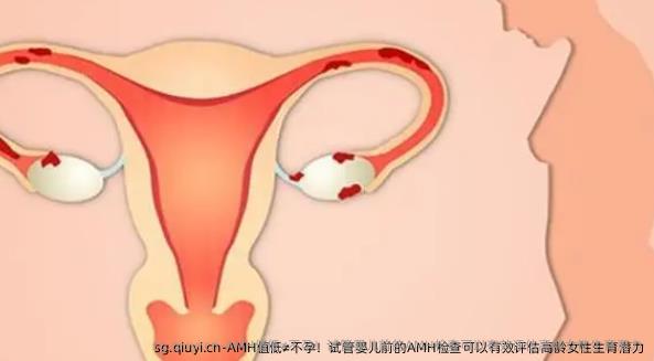 AMH值低≠不孕！试管婴儿前的AMH检查可以有效评估高龄女性生育潜力