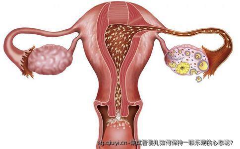 做试管婴儿如何保持一颗乐观的心态呢？