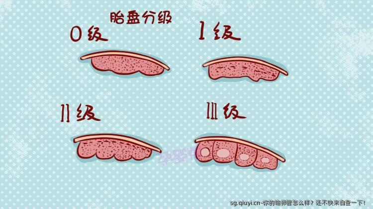 你的输卵管怎么样？还不快来自查一下！
