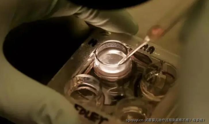 试管婴儿治疗过程到底疼不疼？有多疼？