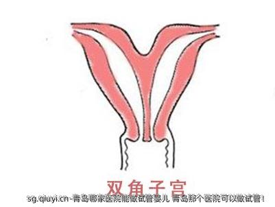 青岛哪家医院能做试管婴儿 青岛那个医院可以做试管！