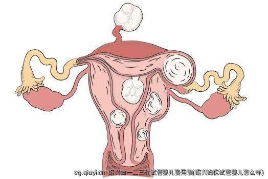 绍兴做一二三代试管婴儿费用表(绍兴妇保试管婴儿怎么样)