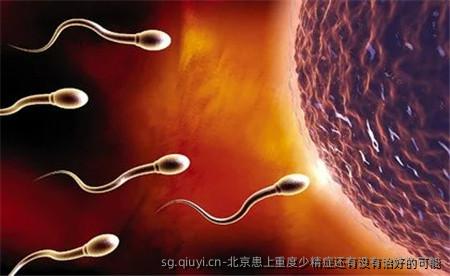 北京患上重度少精症还有没有治好的可能