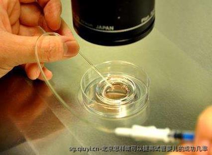 北京怎样做可以提高试管婴儿的成功几率