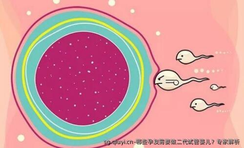 哪些孕友需要做二代试管婴儿？专家解析