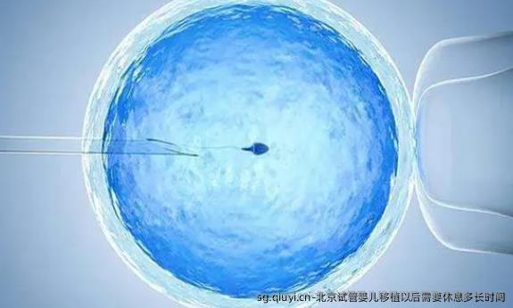 北京试管婴儿移植以后需要休息多长时间