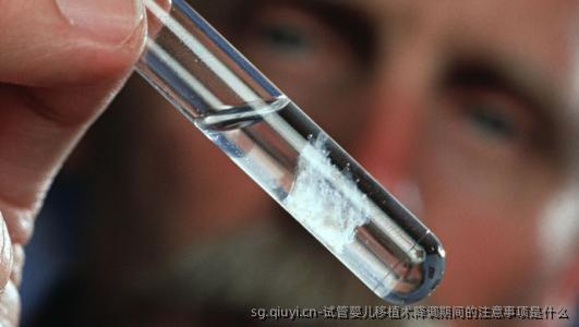 试管婴儿移植术降调期间的注意事项是什么