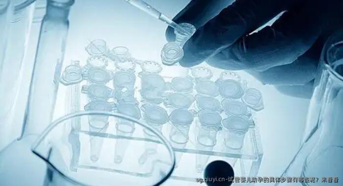 试管婴儿助孕的具体步骤有哪些呢？来看看